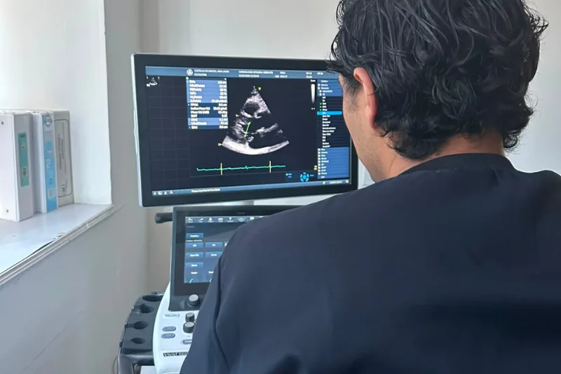 Ecocardiograma