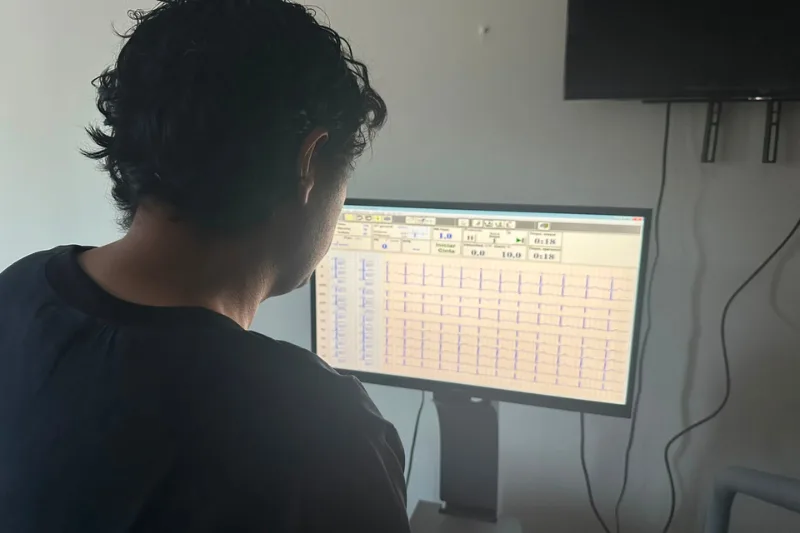 Electrocardiograma (ECG)